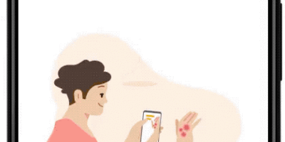 Using AI to help find answers to common skin conditions